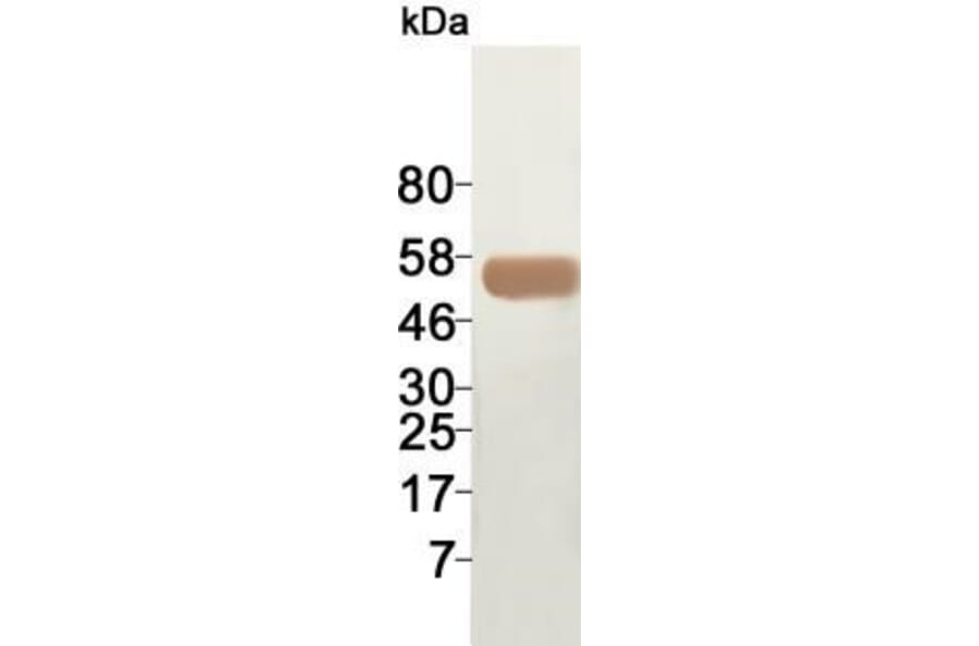 Western Blot - Anti-ACT Antibody (0611711B12) - Antibodies.com