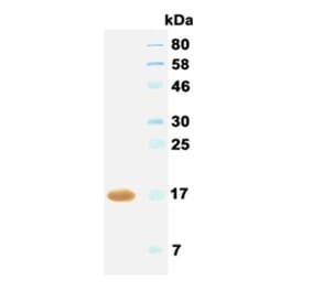 Western Blot - Anti-IFNA2 (IFNα2) Antibody (062402B04) - Antibodies.com