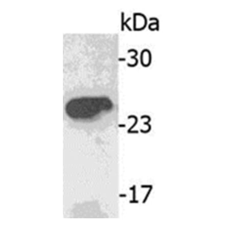 Western Blot - Anti-IGJ Antibody (062607A06) - Antibodies.com