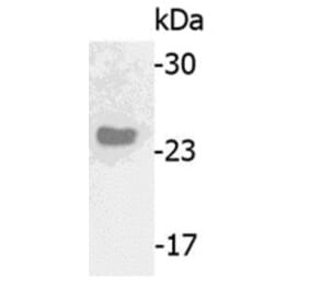 Western Blot - Anti-IGJ Antibody (062615H10) - Antibodies.com
