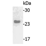 Western Blot - Anti-IGJ Antibody (062615H10) - Antibodies.com