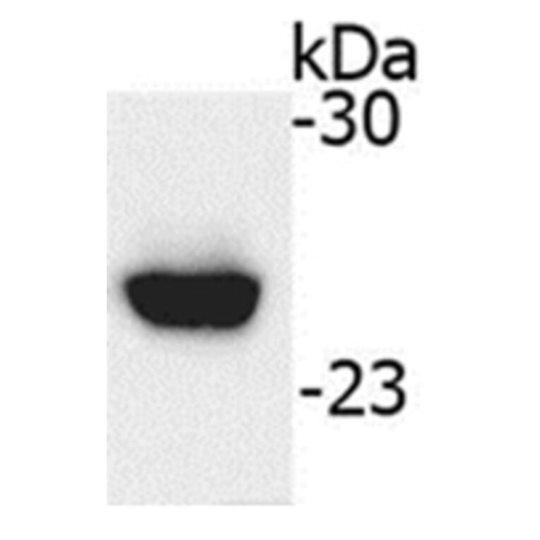 Western Blot - Anti-IGJ Antibody (062615H10) - Antibodies.com