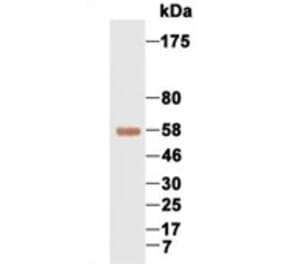 Western Blot - Anti-AFP Antibody (069210F12) - Antibodies.com