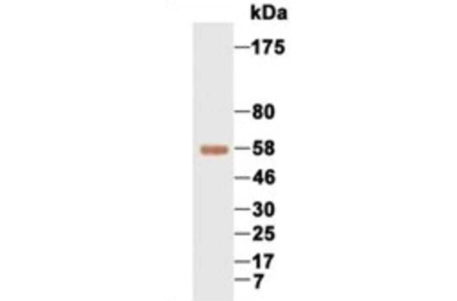 Western Blot - Anti-AFP Antibody (069210F12) - Antibodies.com