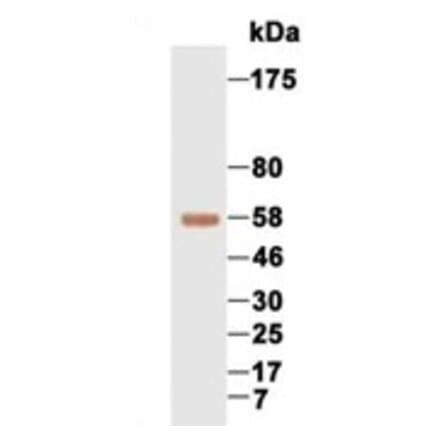 Western Blot - Anti-AFP Antibody (069210F12) - Antibodies.com