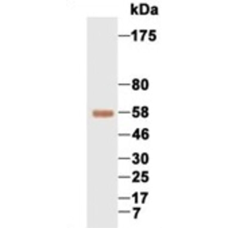 Western Blot - Anti-AFP Antibody (069210F12) - Antibodies.com