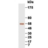 Western Blot - Anti-AFP Antibody (069210F12) - Antibodies.com