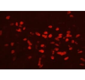 Immunohistochemistry - Anti-GATA3 Antibody (111207H09) - Antibodies.com