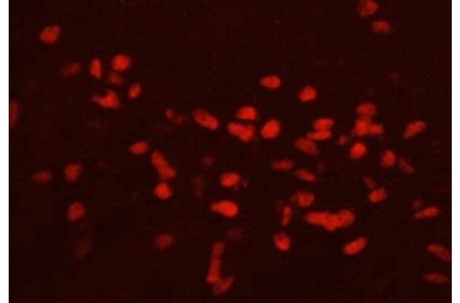 Immunohistochemistry - Anti-GATA3 Antibody (111207H09) - Antibodies.com