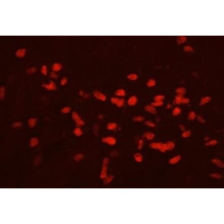 Immunohistochemistry - Anti-GATA3 Antibody (111207H09) - Antibodies.com