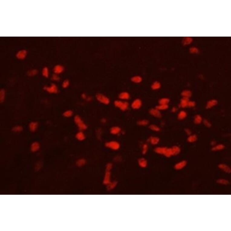 Immunohistochemistry - Anti-GATA3 Antibody (111207H09) - Antibodies.com