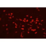 Immunohistochemistry - Anti-GATA3 Antibody (111207H09) - Antibodies.com