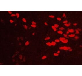 Immunohistochemistry - Anti-GATA3 Antibody (111214D02) - Antibodies.com