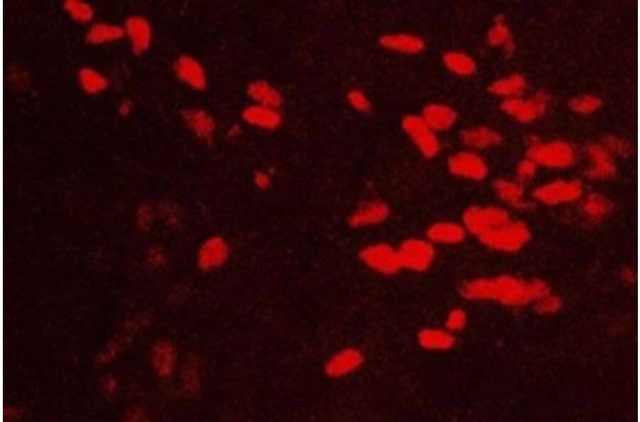 Immunohistochemistry - Anti-GATA3 Antibody (111214D02) - Antibodies.com