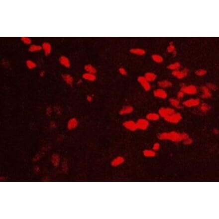 Immunohistochemistry - Anti-GATA3 Antibody (111214D02) - Antibodies.com