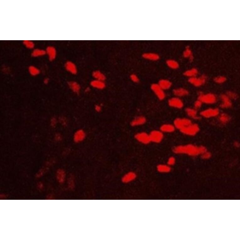 Immunohistochemistry - Anti-GATA3 Antibody (111214D02) - Antibodies.com