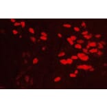 Immunohistochemistry - Anti-GATA3 Antibody (111214D02) - Antibodies.com
