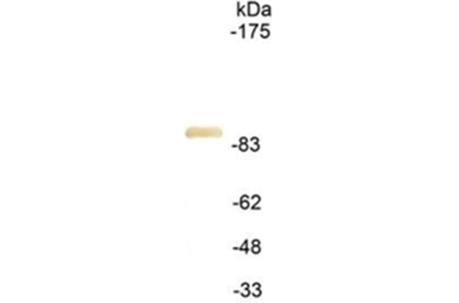 Western Blot - Anti-HA Tag Antibody (111614A09) - Antibodies.com