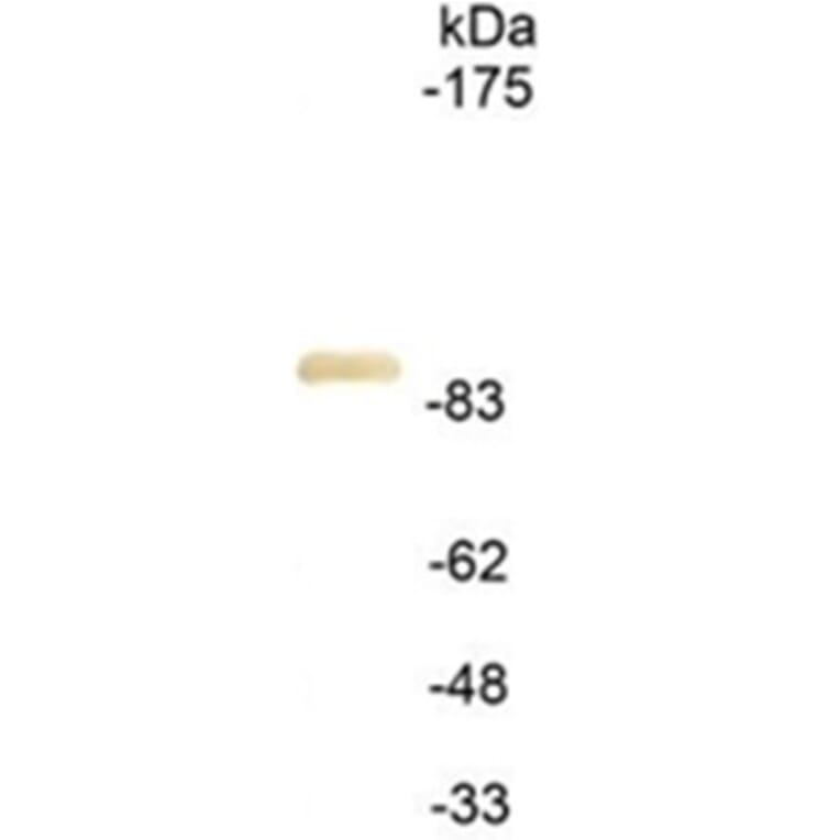 Western Blot - Anti-HA Tag Antibody (111614A09) - Antibodies.com