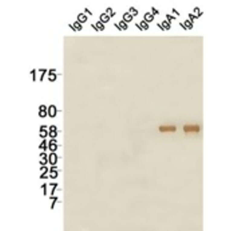 Western Blot - Anti-IgA Antibody (115604G07) - Antibodies.com