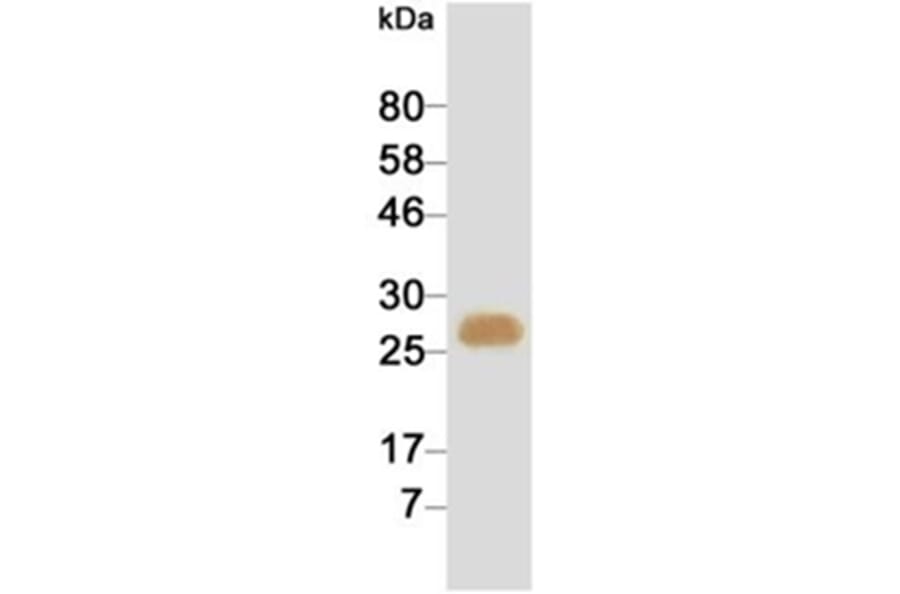 Western Blot - Anti-cTnI Antibody (HRP) (116808G02H) - Antibodies.com