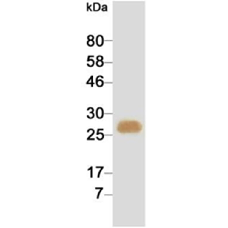 Western Blot - Anti-cTnI Antibody (HRP) (116808G02H) - Antibodies.com