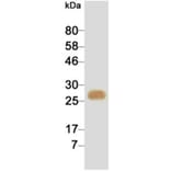 Western Blot - Anti-cTnI Antibody (HRP) (116808G02H) - Antibodies.com