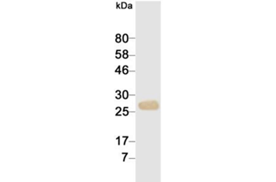 Western Blot - Anti-cTnI Antibody (116816G10) - Antibodies.com