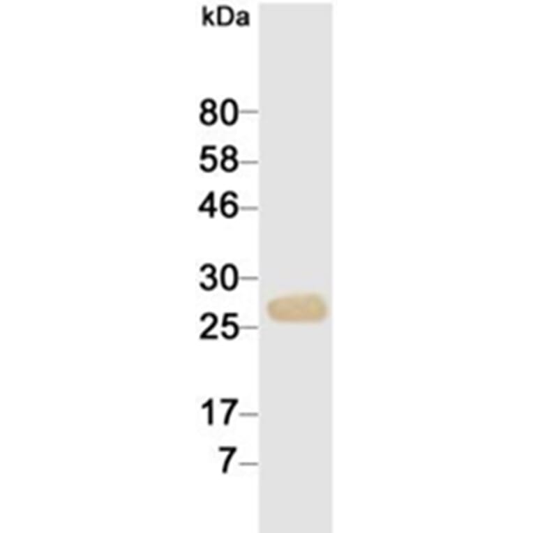 Western Blot - Anti-cTnI Antibody (116816G10) - Antibodies.com