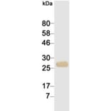 Western Blot - Anti-cTnI Antibody (116816G10) - Antibodies.com
