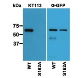 Western Blot - Anti-S162 phospho-MAPRE3 (EB3) Antibody (163403D12) - Antibodies.com