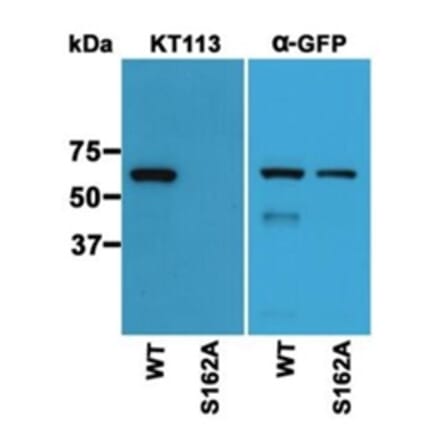 Western Blot - Anti-S162 phospho-MAPRE3 (EB3) Antibody (163403D12) - Antibodies.com