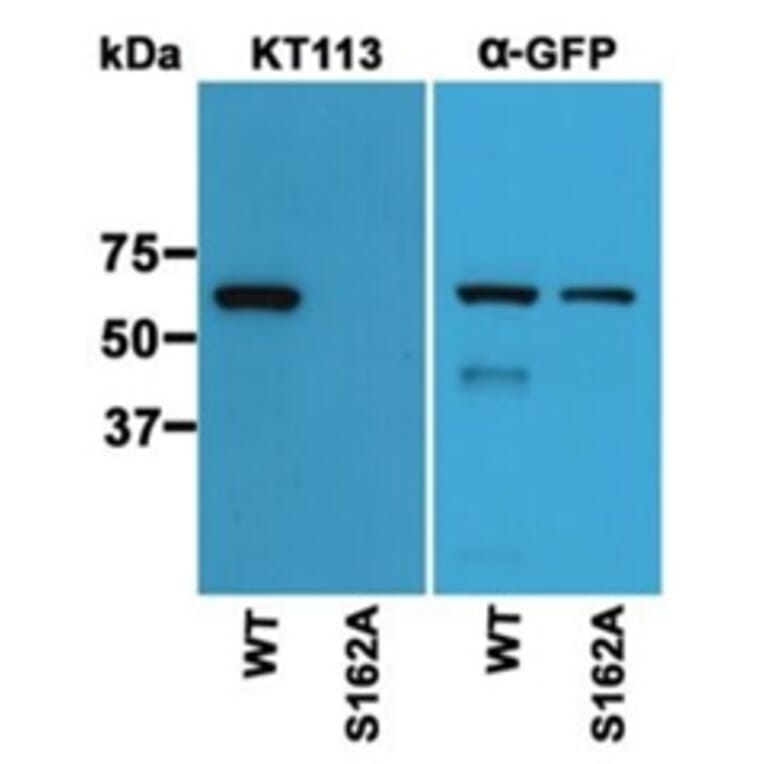 Western Blot - Anti-S162 phospho-MAPRE3 (EB3) Antibody (163403D12) - Antibodies.com