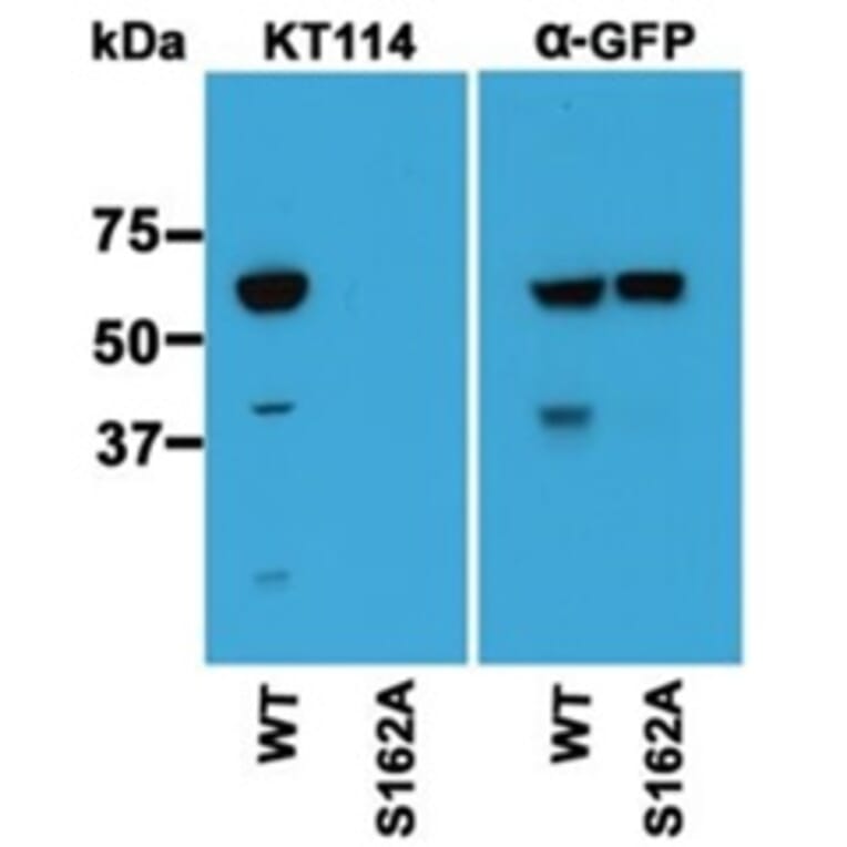 Western Blot - Anti-S162 phospho-MAPRE3 (EB3) Antibody (163404B07) - Antibodies.com