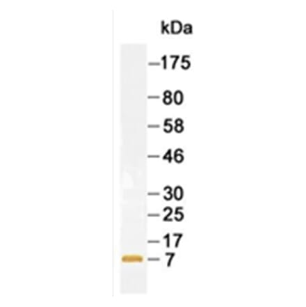 Western Blot - Anti-B2M Antibody (167214B12) - Antibodies.com