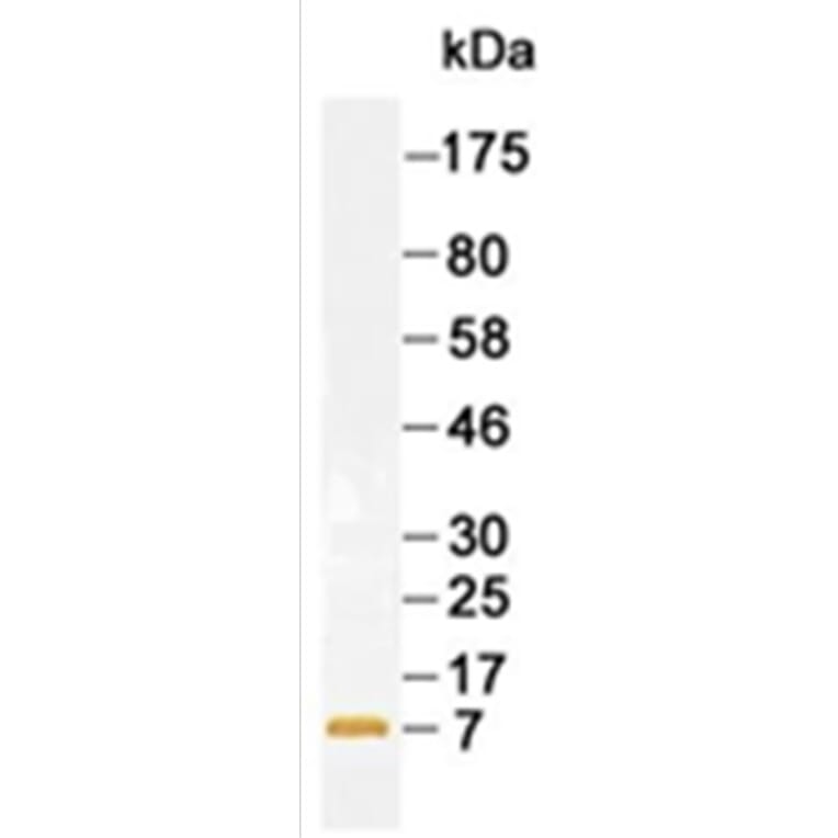 Western Blot - Anti-B2M Antibody (167214B12) - Antibodies.com