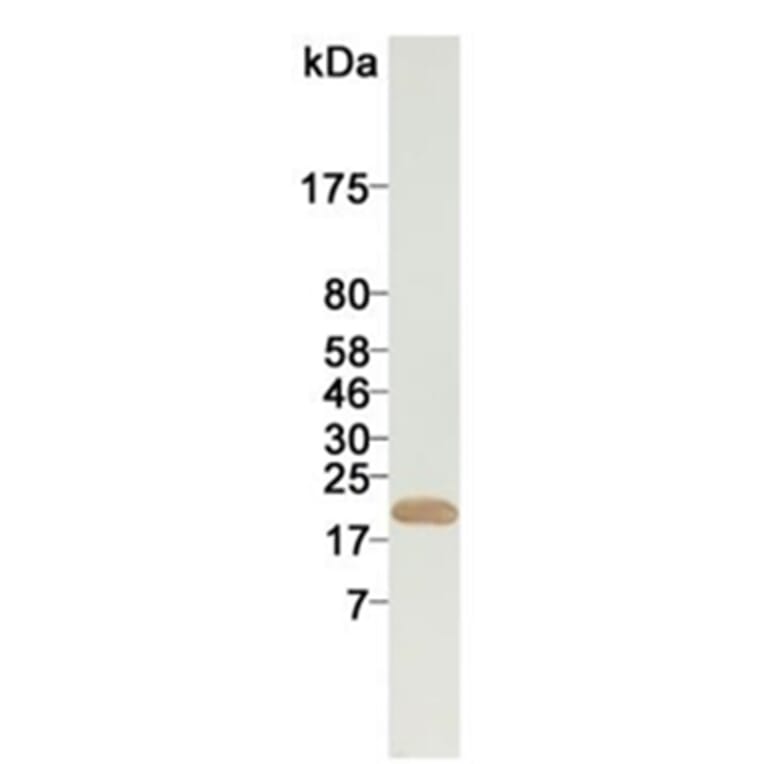 Western Blot - Anti-Ferritin Antibody (168215A10) - Antibodies.com