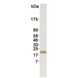 Western Blot - Anti-Ferritin Antibody (168215A10) - Antibodies.com