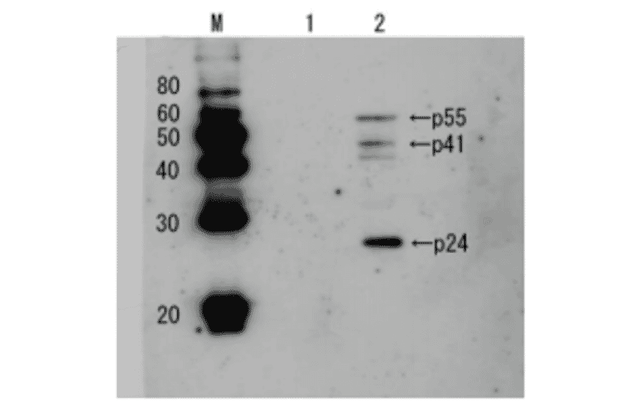 Detection of HIV-1 p24 and precursor proteins p55 and p41 by Western blotting using the anti p24 antibody (unconjugated)). 