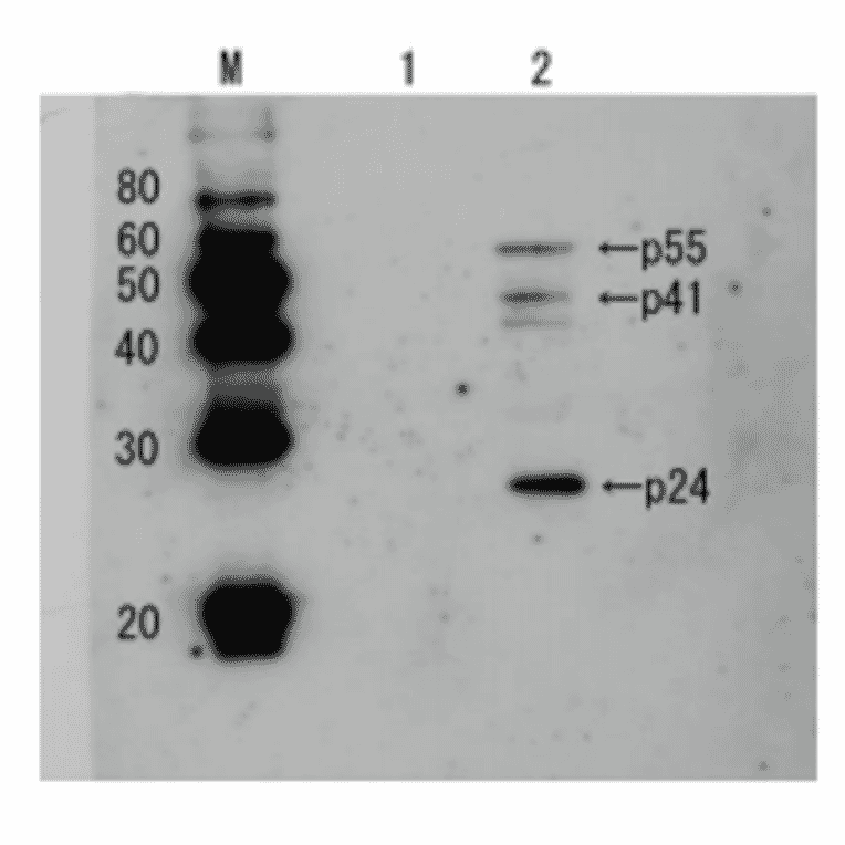 Detection of HIV-1 p24 and precursor proteins p55 and p41 by Western blotting using the anti p24 antibody (unconjugated)). 