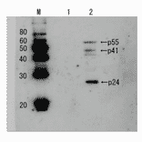 Detection of HIV-1 p24 and precursor proteins p55 and p41 by Western blotting using the anti p24 antibody (unconjugated)). 