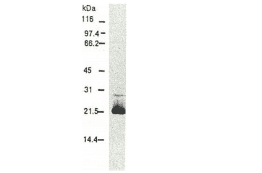 Western blotting of HCV core protein.Chimp liver cells were infected with recombinant vaccinia virus containing a HCV genome cDNA and were subjected to Western blotting using this antibody. The core protein is detected as a 22-kDa band. 