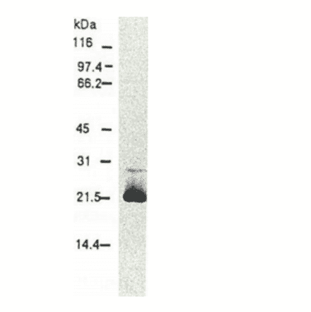 Western blotting of HCV core protein.Chimp liver cells were infected with recombinant vaccinia virus containing a HCV genome cDNA and were subjected to Western blotting using this antibody. The core protein is detected as a 22-kDa band. 