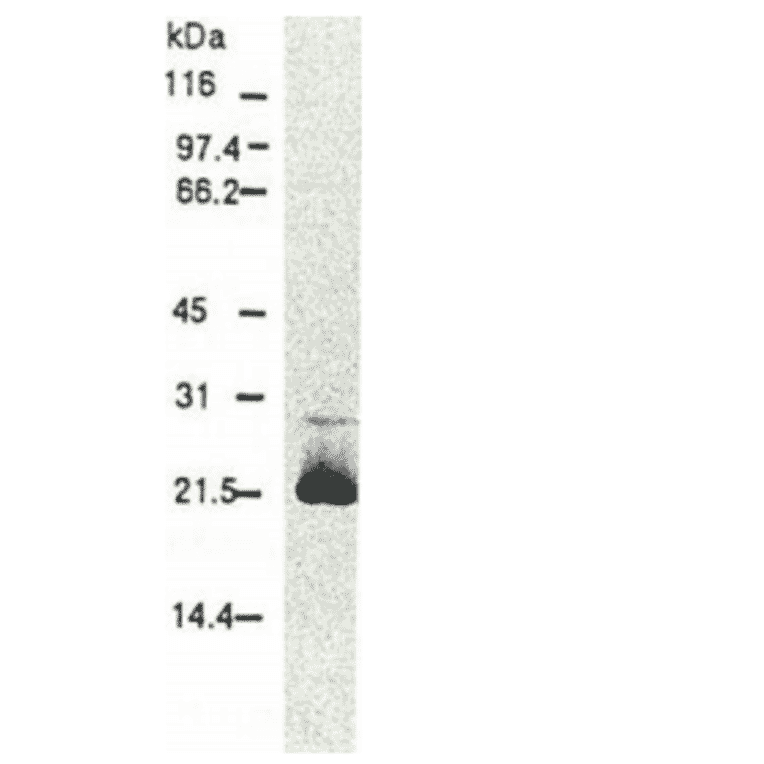 Western blotting of HCV core protein.Chimp liver cells were infected with recombinant vaccinia virus containing a HCV genome cDNA and were subjected to Western blotting using this antibody. The core protein is detected as a 22-kDa band. 