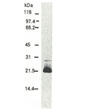 Western blotting of HCV core protein.Chimp liver cells were infected with recombinant vaccinia virus containing a HCV genome cDNA and were subjected to Western blotting using this antibody. The core protein is detected as a 22-kDa band. 