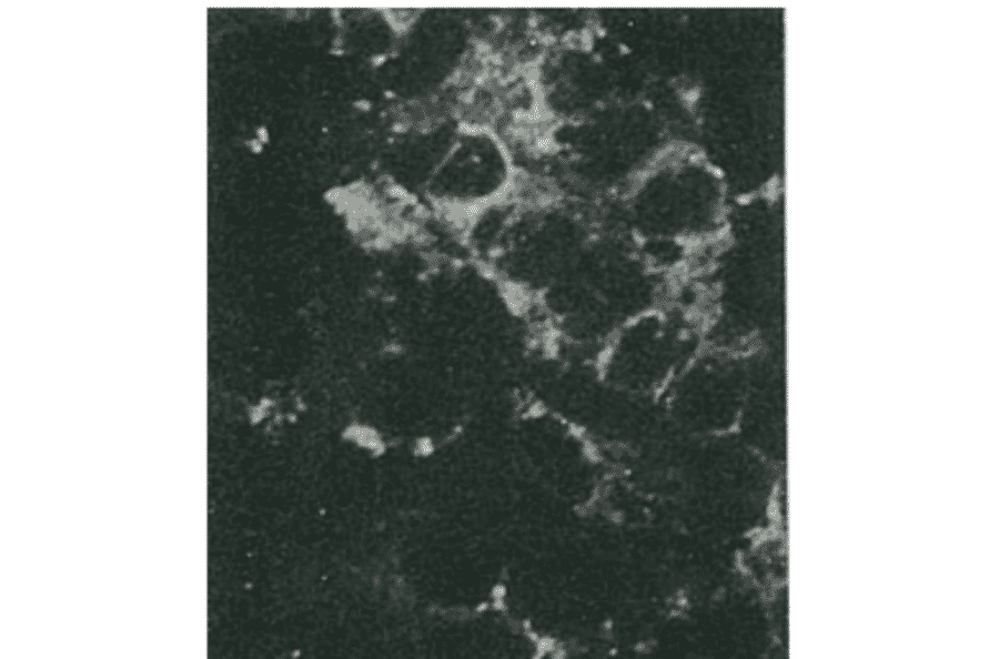Detection of HCV core protein by immunofluorescence antibody staining. Chimp liver cells were infected with recombinant vaccinia virus containing a HCV genome cDNA. After incubation for 48 hr, the cells were fixed with acetone and HCV core protein was detected by indirect immunofluorescence staining using this antibody. 