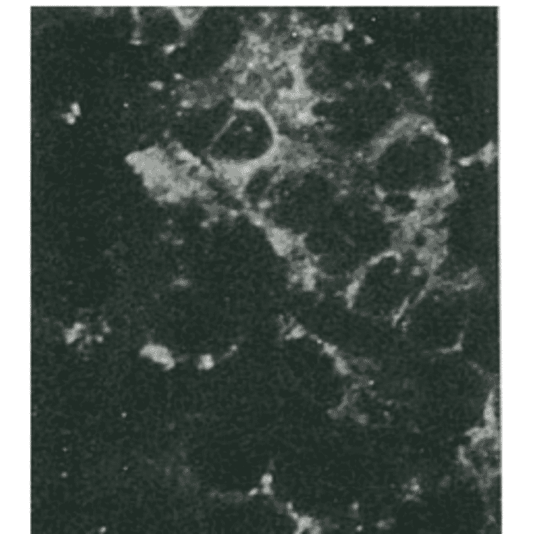 Detection of HCV core protein by immunofluorescence antibody staining. Chimp liver cells were infected with recombinant vaccinia virus containing a HCV genome cDNA. After incubation for 48 hr, the cells were fixed with acetone and HCV core protein was detected by indirect immunofluorescence staining using this antibody. 