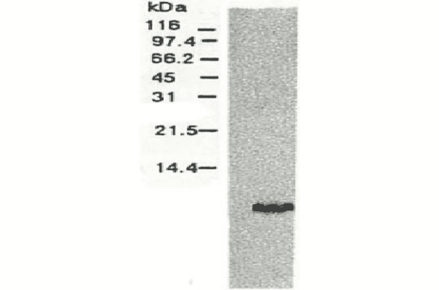 Western blotting of HCV NS4a protein.Chimp liver cells were infected with recombinant vaccinia virus containing a HCV genome cDNA and were subjected to Western blotting using anti-NS4a antibody. The protein detected with this antibody is 6 kD. This small NS4 protein (NS4a) was produced from the N-terminal region of the NS4 protein. 