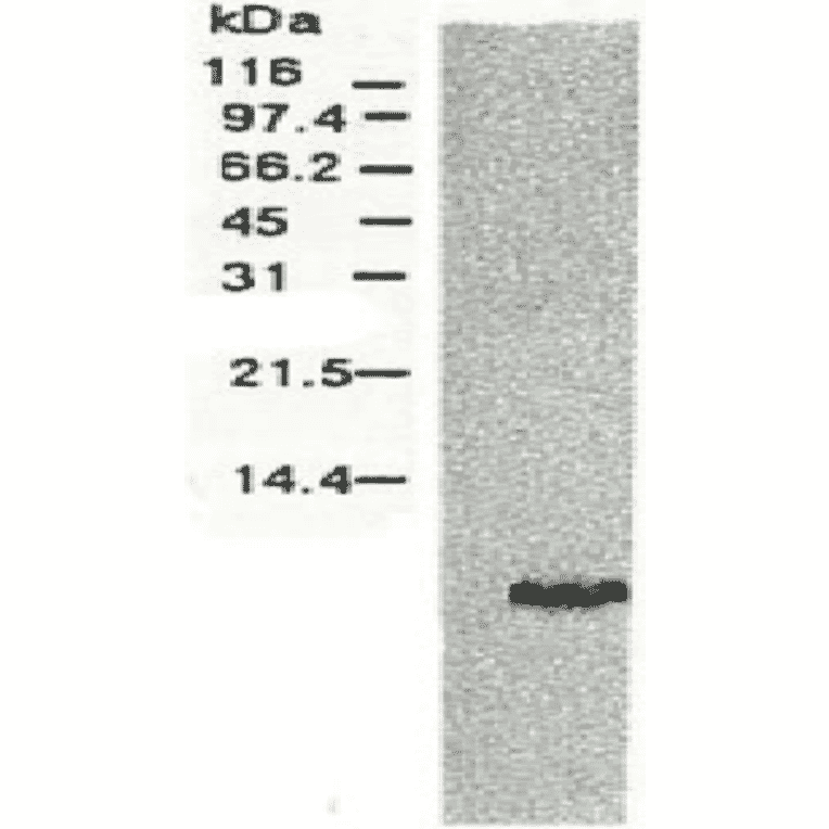 Western blotting of HCV NS4a protein.Chimp liver cells were infected with recombinant vaccinia virus containing a HCV genome cDNA and were subjected to Western blotting using anti-NS4a antibody. The protein detected with this antibody is 6 kD. This small NS4 protein (NS4a) was produced from the N-terminal region of the NS4 protein. 