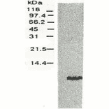 Western blotting of HCV NS4a protein.Chimp liver cells were infected with recombinant vaccinia virus containing a HCV genome cDNA and were subjected to Western blotting using anti-NS4a antibody. The protein detected with this antibody is 6 kD. This small NS4 protein (NS4a) was produced from the N-terminal region of the NS4 protein. 